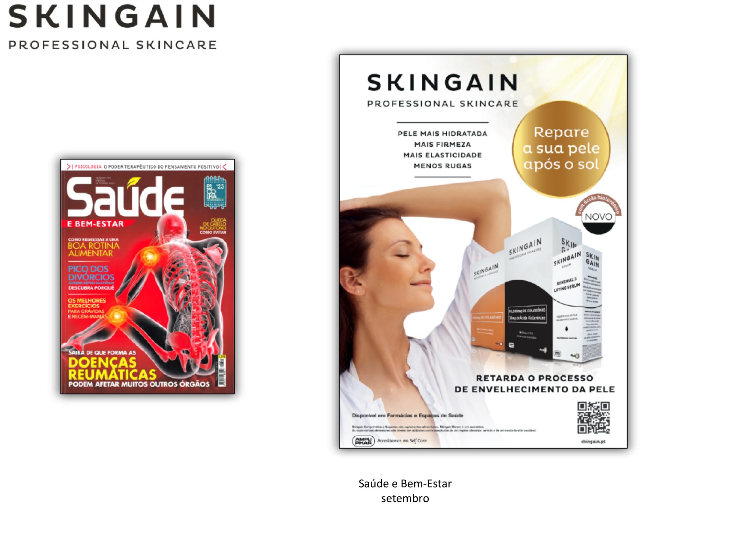 Skingain